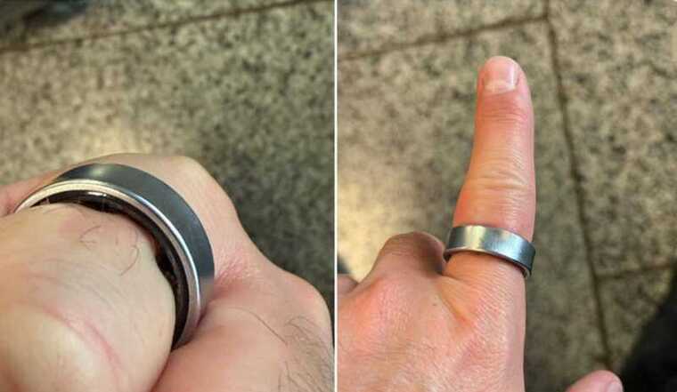 IT-специалист едва не потерял палец из-за опухшего кольца Samsung